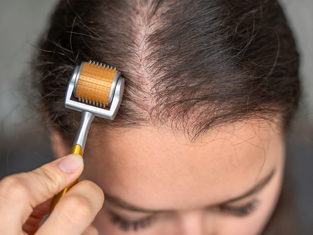 Can Derma Rolling Support Hair Regrowth?