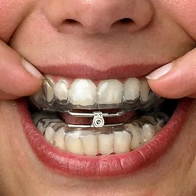 How Much Do Dental Activators Cost?