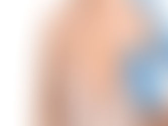 What Are the Types of Breast Reconstruction?