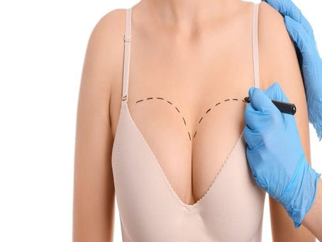 What Are the Types of Breast Reconstruction?