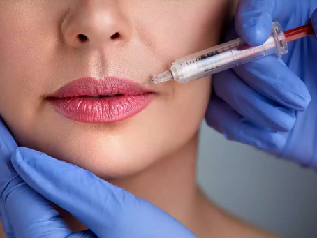 Can Russian Fillers Correct Uneven Lip Shapes?
