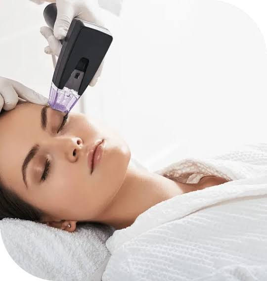 Does Morpheus8 Treatment Help Minimize Enlarged Pores?