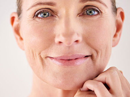 Are Sugar Thread Lifts Effective for Wrinkle Reduction?