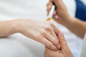 Can Radiance Peel Be Used On Hands And Arms?