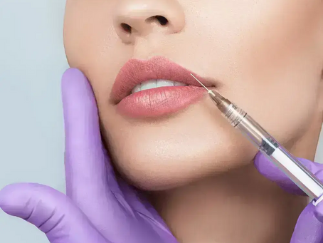 Can Volbella Be Used to Define and Contour the Lips?