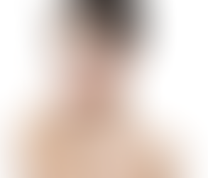 What Is the Most Effective Tan Removal Treatment for Oily Skin?