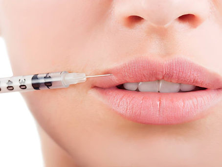 Can Lip Fillers Refine Overall Facial Features?
