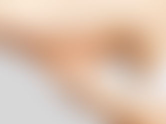 Can Ultrasound Cavitation Target Fat Around the Arms?