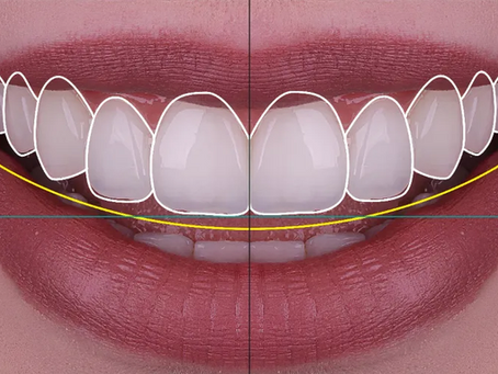 Is Digital Smile Design Appropriate for All Patients?