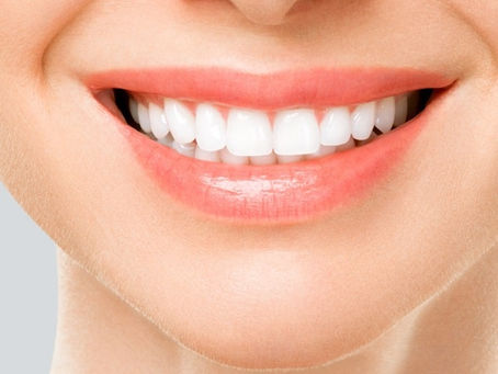 Can Hollywood Smile Design Improve Tooth Alignment?