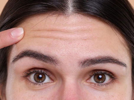 Do Facelifts Tighten Forehead and Eyes?