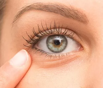 Can Eye Bag Removal Improve Skin Tightness Beneath the Eyes?