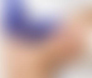 Can Macrolane Help Correct Uneven Body Contours?