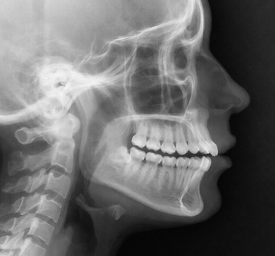RadiographTypes5.png