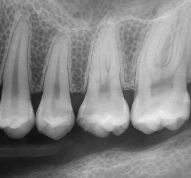 RadiographTypes2.png