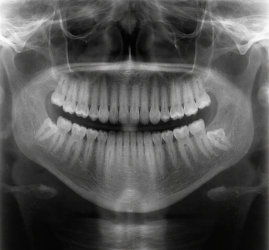 RadiographTypes3.png