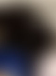 Echo