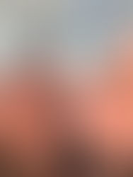 Side-by-side images of a woman's profile before and after a cosmetic procedure. Certificates hang on a wall in the blurred background.