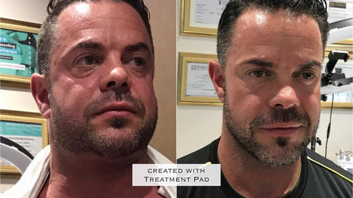 Men's Aesthetics Results in Kent