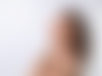Lower Face Botox Maidstone: Jawline & Chin Refinement
