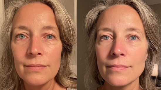 Exosomes Before and After in Kent