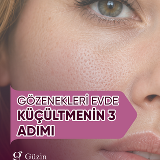 Gözenekleri Evde Küçültmenin 3 Bilimsel Adımı: Asla Kapanmayan Gözenekler İçin Rehber