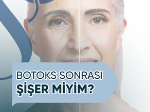 Botoks Sonrası Şişer Miyim?