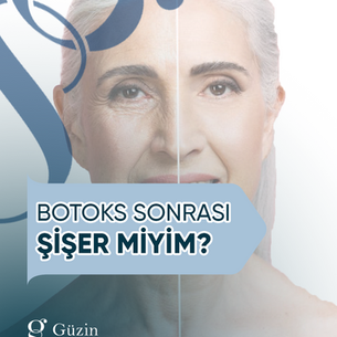 Botoks Sonrası Şişer Miyim?