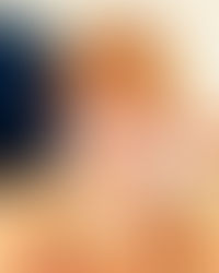 SÉANCE D’HYPNOSE POUR MAIGRIR ?