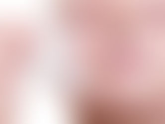 Winter & Chemical Peel
