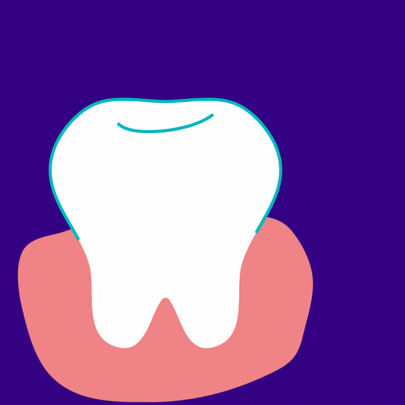 Signs you need a root canal