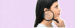 banner-cancer-piel
