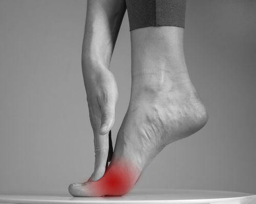 What is Morton's neuroma?