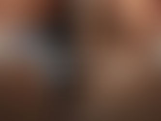 Пигментация на кожата: видове, причини, превенция и ефективно лечение!