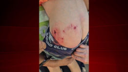 Niño fue atacado por un pitbull en Santa Librada: Menor sufrió graves mordeduras tras ser atacado por el perro