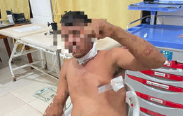 Hombre apuñalado en partido de vóley: Tras una discusión con otro jugador, quien se dio a la fuga