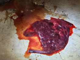 Hallan presunta placenta humana: La fiscalía investiga el hallazgo en un departamento céntrico