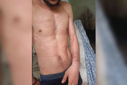 Madre denuncia secuestro y tortura a su hijo: Joven de 23 años fue denunciado por supuesto robo de gallinas