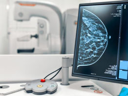 Se habilita servicio de mamografía en policlínico de Hohenau