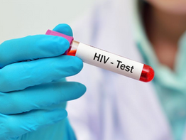Test rápidos disponibles totalmente gratuitos: Ante alto índice de personas con VIH SIDA