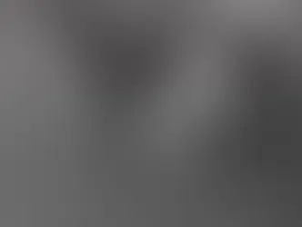 Joven que iba a su pasantía fue asaltada y apuñalada por motochorros en Luque