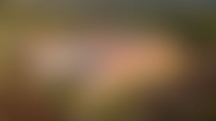 Histórico avance en salud: El Hospital General de Itapúa realizará resonancias magnéticas domingos y feriados