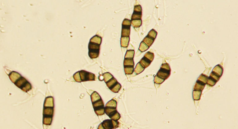 Conidia of Neopestalotiopsis rosae