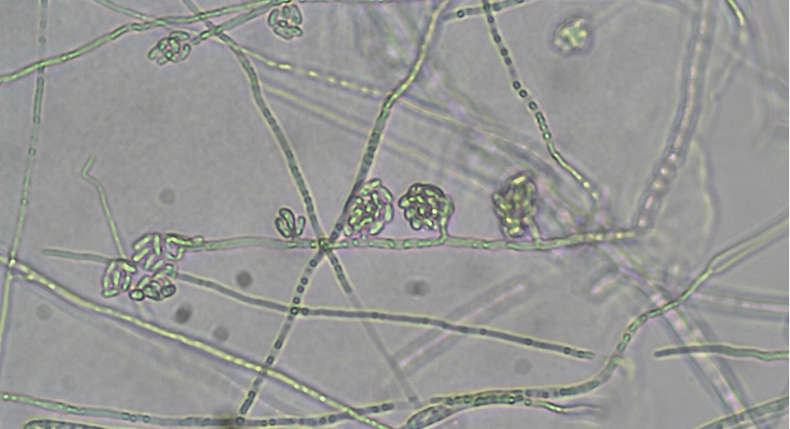 False heads carried on phialides of a Fusarium spp.