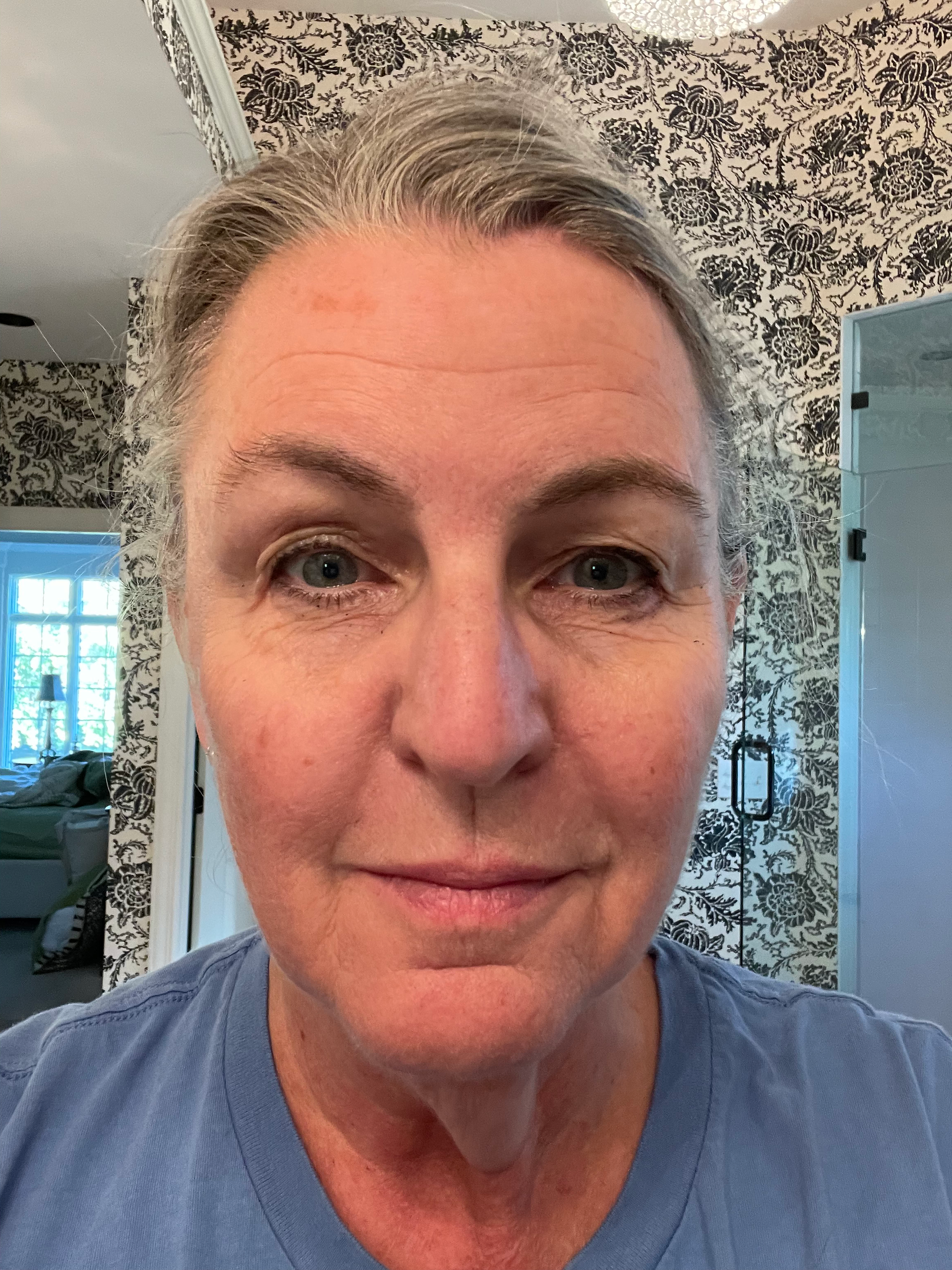 kojic acid pads