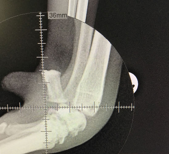 xray.jpg
