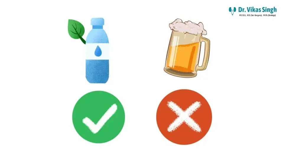 Kidney Stones & Alcohol: Why beer is NOT a solution! Urologist Dr. Vikas Singh clarifies safe hydration for kidney stone prevention & treatment.