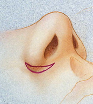 dessin de reduction des ailes du nez