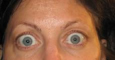 Before image of pemanent makeup in Beverly Hills
