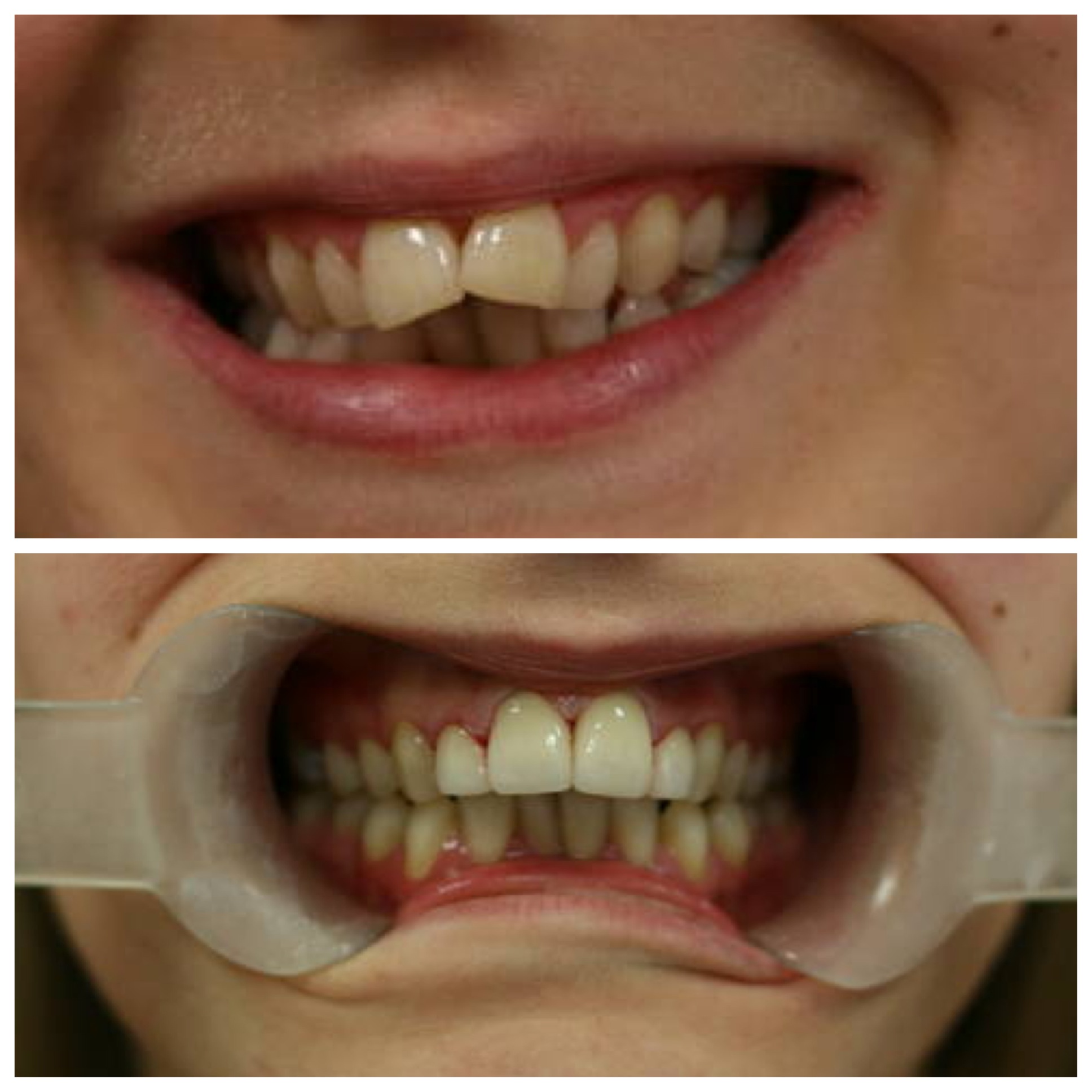 Smile No. 41